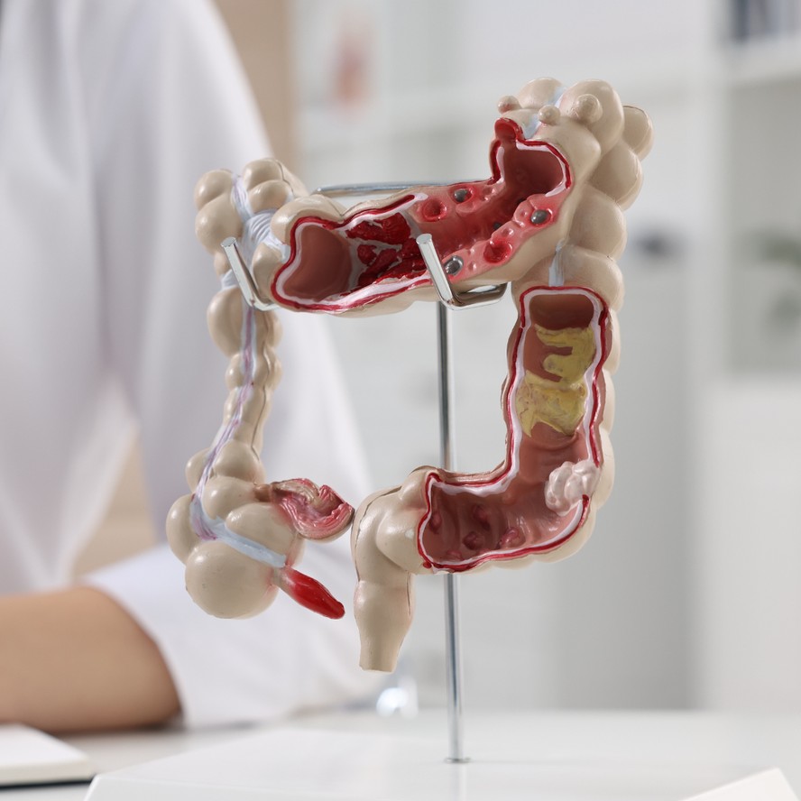 Anatomia do Intestino — Foto: Nutricionista Adrian Bester
