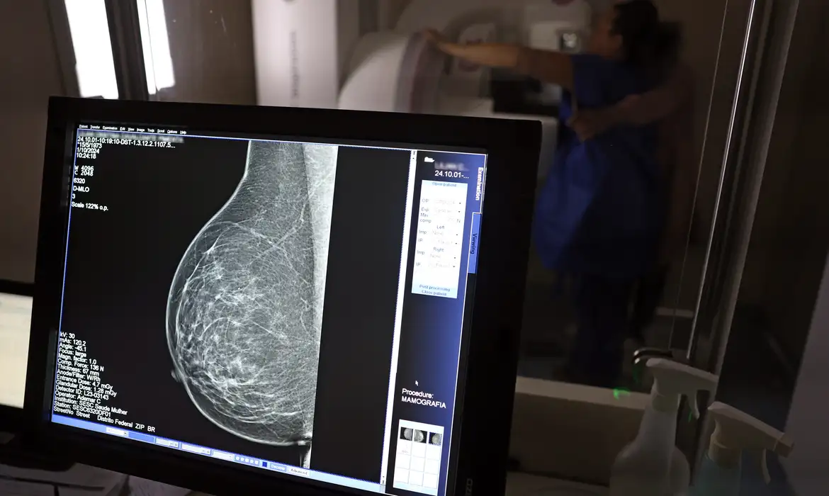 Imagem sobre mamografia digital. Foto: José Cruz/Agência Brasil